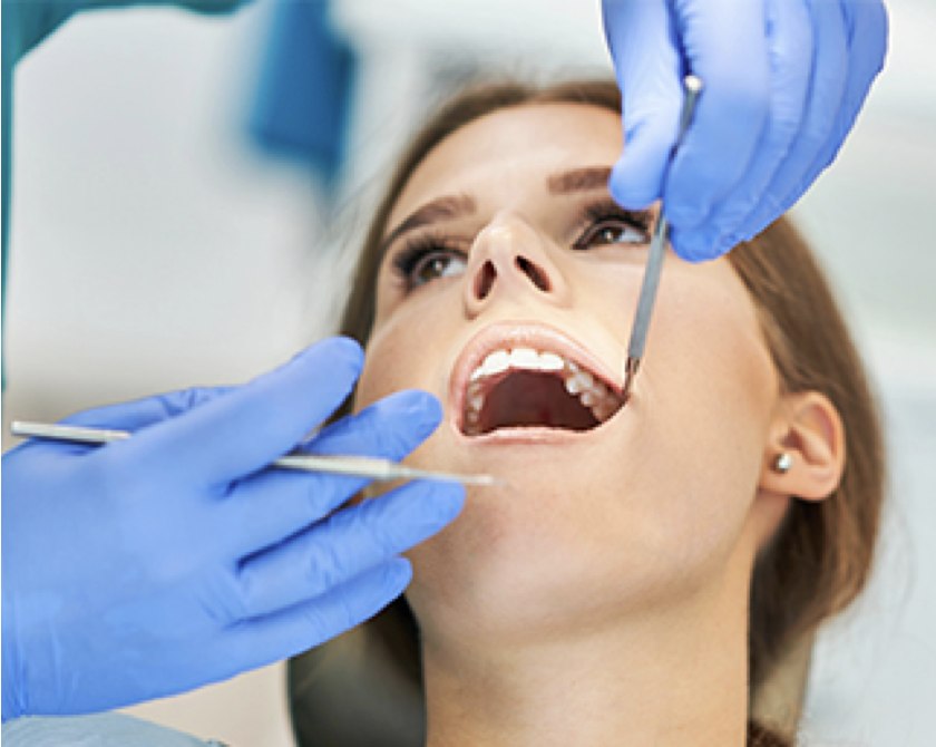 ¿El Seguro Dental de Mapfre cubre las extracciones?